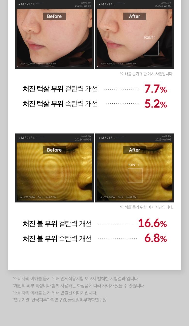 메디큐브 에이지알 더마 EMS 샷 + 전용 탄력 부스터 + 거치대 세트