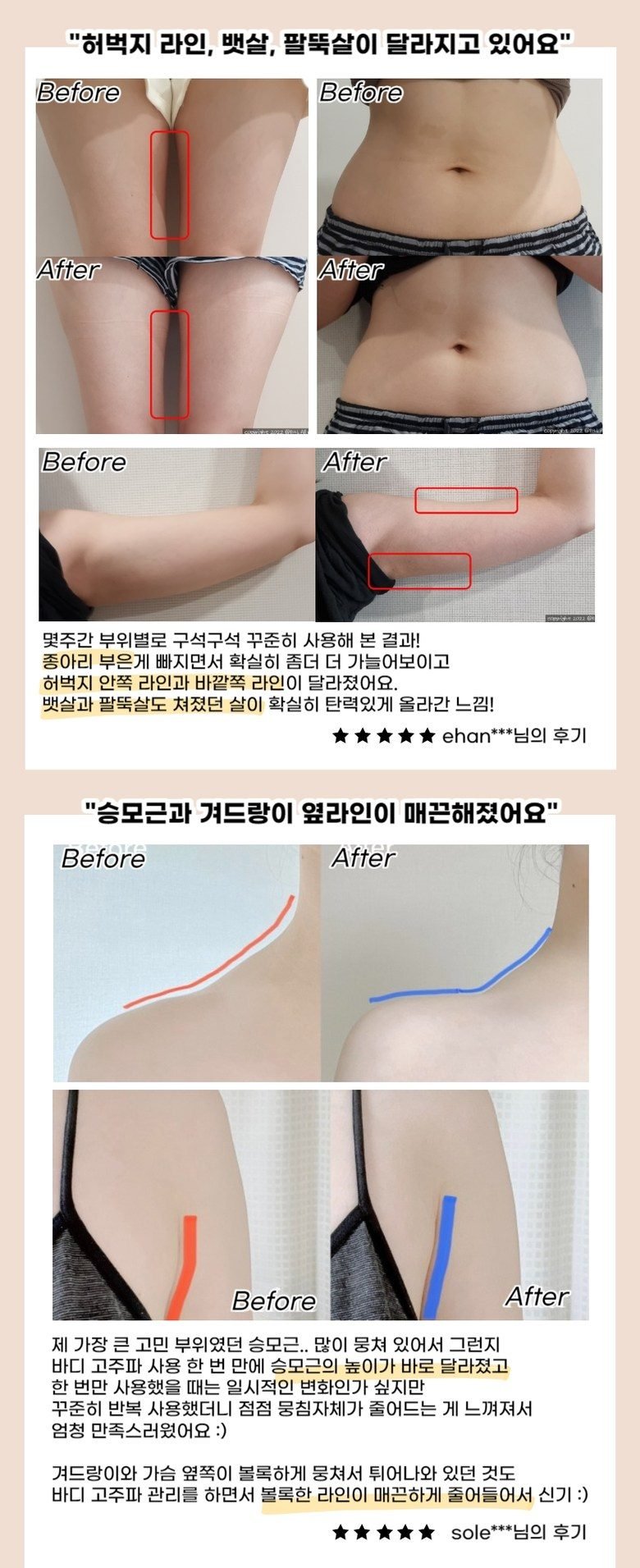 이로위로 바디 고주파 마사지기 온열 갈바닉 초음파 바본관리 가정용고주파기 홈케어 뷰티디바이스