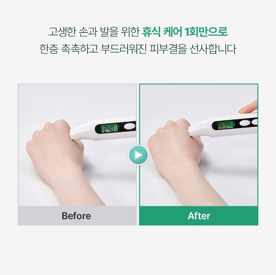 [하루10분 손목찜질로 시원하게!] 하루미담 가정용 파라핀 치료기x병원용 왁스 모음